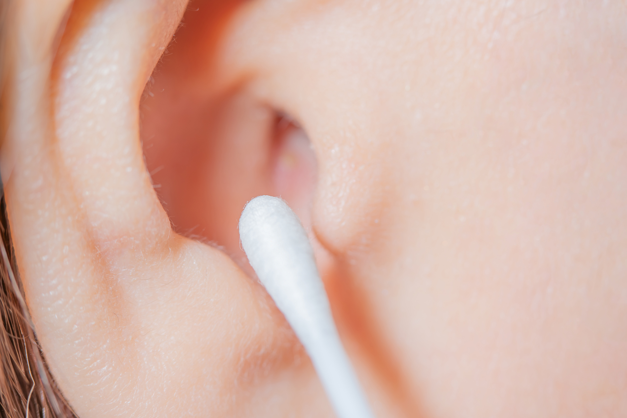耳垢をごっそりとる方法は？自分でやる際のコツと注意点を解説！