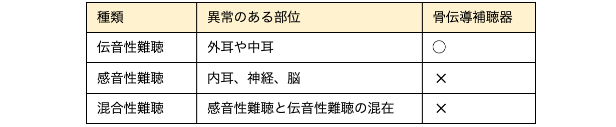 骨伝導補聴器の仕組みや種類 メリットやデメリットをまとめて解説 オリーブスマートイヤープラス 公式サイト